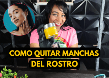 como quitar manchas cara naturalmente