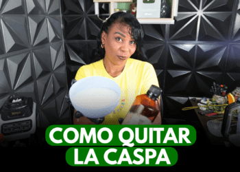 como quitar la caspa naturalmente
